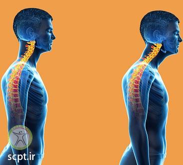 http://scpt.ir/uploads/neck physiotherapy 3.jpg