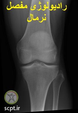 http://scpt.ir/uploads/normal-knee-x-ray.jpg
