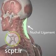 http://scpt.ir/uploads/nuchal ligament tear whiplash injury.jpg