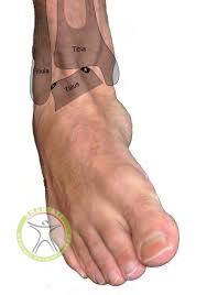 http://scpt.ir/uploads/osteochondritis-dissecans-ankle-signs-and-symptoms.jpg