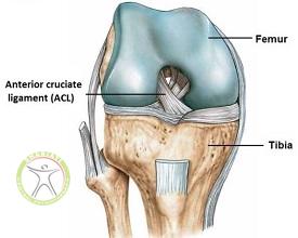 http://scpt.ir/uploads/photo-of-cruciate-ligament-rupture-4.jpg