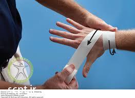 http://scpt.ir/uploads/scaphoid fracture taping.jpg