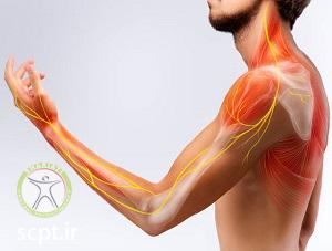 http://scpt.ir/uploads/shoulder physiotherapy shariati.jpg