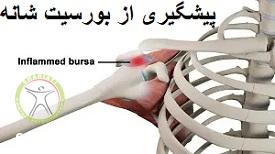 http://scpt.ir/uploads/shoulder-bursitis-prevention.jpg