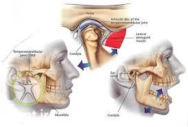 http://scpt.ir/uploads/temporomandibular joint anatomy dysfunction.jpg