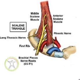 http://scpt.ir/uploads/thoracic-outlet-syndrome-3.jpg