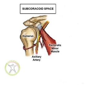http://scpt.ir/uploads/thoracic-outlet-syndrome-4.jpg