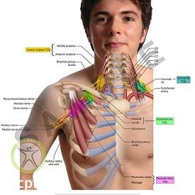 http://scpt.ir/uploads/thoracic-outlet-syndrome-6.jpg