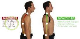 http://scpt.ir/uploads/thoracic-outlet-syndrome-postural.jpg