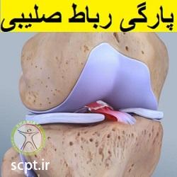 http://scpt.ir/uploads/torn-anterior-cruciate-ligament-1.jpg