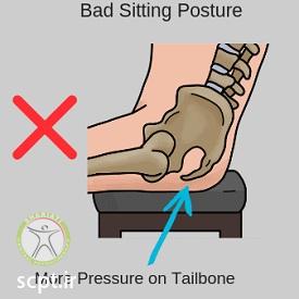 http://scpt.ir/uploads/treatment-of-tailbone-pain-sitting-position-bad-posture.jpg