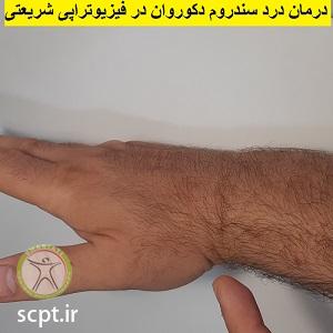 http://scpt.ir/uploads/wrist-pain-de-duervains-syndrome.jpg